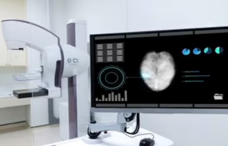 英国启动 70 万人全球最大规模乳腺癌 AI诊断实验，有望解放数百名医生